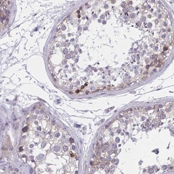 PERQ2 Antibody, Novus Biologicals:Antibodies:Primary Antibodies